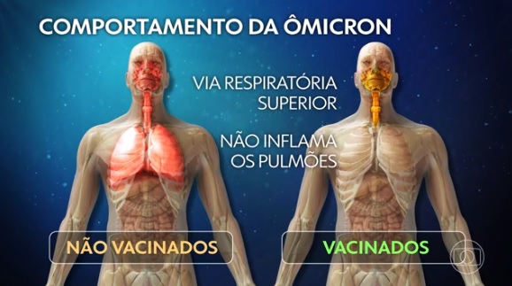 ÔMICRON AFETA VACINADOS DE FORMA DIFERENTE E TORNA CASOS MENOS GRAVES